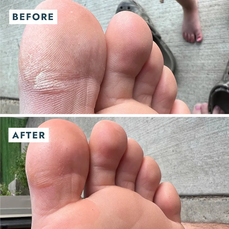 Heel Repair Duo